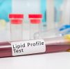 Blood Testing : Cholesterol Lipid Profile