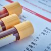 Blood Testing : Heart Health Profile