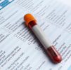 Blood Testing : Premier Health Profile