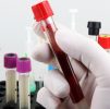 Blood Testing : Progesterone