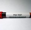 Blood Testing : Prostate Specific Antigen