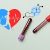 Blood Testing : Sports Hormone Profile