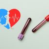 Blood Testing : Sport Fitness Profile