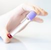 Blood Testing : Female Hair Loss Profile ADV (Advanced) 