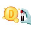 Blood Testing : Vitamin D