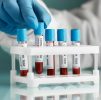 Blood Testing : General Health Profile