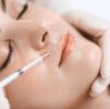 Botulinum Toxin (Botox) : Gummy Smile