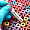 Blood Testing : General Well Person Profile plus Full Cholesterol Profile (DL6L)