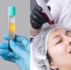 Micro-needling : Platelet-Rich Plasma (PRP) Facial - 3 Sessions (1 Session - every 4 weeks)