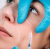 Face Conturing / Dermal Filler Treatments : 8 Point Non-Surgical Facelift