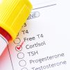 Blood Testing : Hair Loss Male Profile Advanced Hormone & Health Check