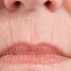 Platelet Rich Plasma (PRP) : PRP FACIAL GLOW