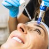 Platelet Rich Plasma (PRP) : PRP VAMPIRE FACIAL