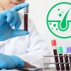 Blood Testing : Hair Loss Profile