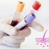 Blood Testing : Hair Loss Profile Female - Bespoke