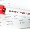 Blood Testing : Cholesterol 