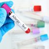 Blood Testing : Allergy Complete -295 allergens tested