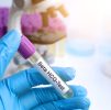 Blood Testing : Beta-HCG (Quantitative ) (Pregnancy) HCG