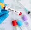 Blood Testing : Calcium