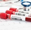 Blood Testing