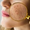 Skin Lesion Assessment