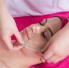 Skin Peel
