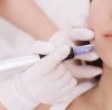 Skin Boosters