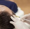 Biotin Hair Growth Injections