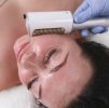 Skin Lesion Removal / Cryosurgery