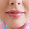 Classic Lip Enhancement 