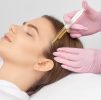 Hair Loss : PRP (Platelet-Rich Plasma) 