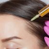 Hair Loss : Hair Recovery Program 