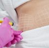 Non-Surgical Fat Reduction: Lemmon Bottle NON surgical Fat Reduction Inner Thighs