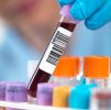 Phlebotomy only (blood draw only, bring your own test request / kit) : Phlebotomy – Private Blood Collection Service