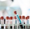 Blood Testing : Vitamin Profile 1
